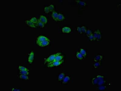 MATN3 / Matrilin 3 Antibody (aa277-486)