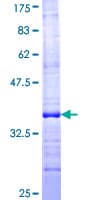 Human TUSC2 / FUS1 Protein (Recombinant GST, N-terminus)