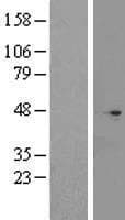 CNPPD1 Protein (Over-Expression Lysate Myc-DDK (Flag))