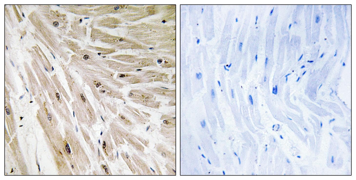 RPL22 / Ribosomal Protein L22 Antibody