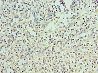 PADI4 / PAD4 Antibody (aa1-250)