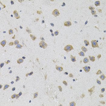 OPRS1 / SIGMAR1 Antibody