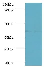 SERPINB5 / Maspin Antibody (aa21-189)
