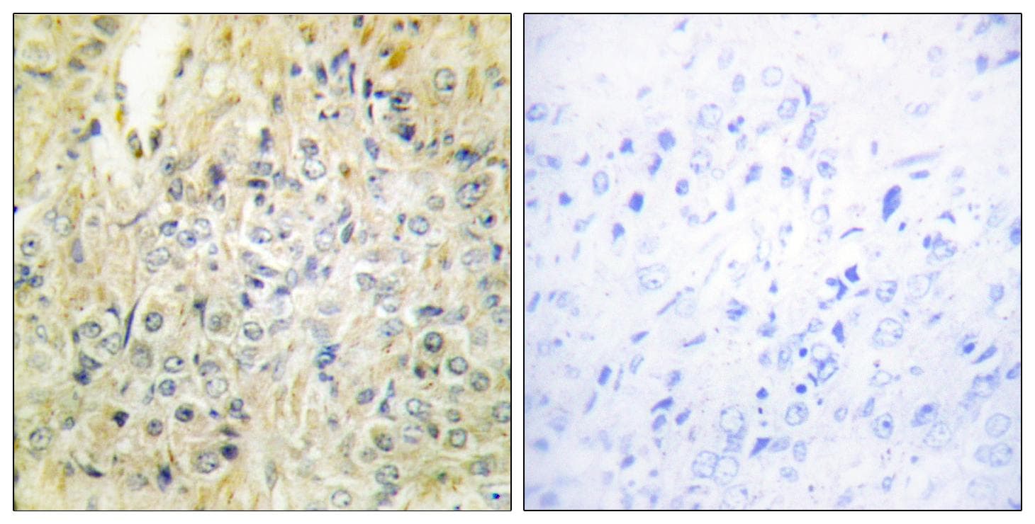 Polyclonal Rabbit anti-Human DLEC1 / DLC1 Antibody (IHC, IF)