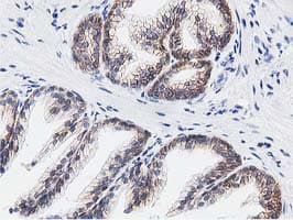 RTFDC1 Antibody (clone OTI1E8)