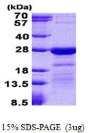 Human HN1L Protein (Recombinant His)