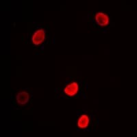 L3MBTL3 Antibody