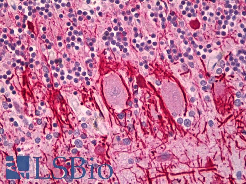 PathPlus™ Neurofilament Antibody (clone 2F11, Concentrated)