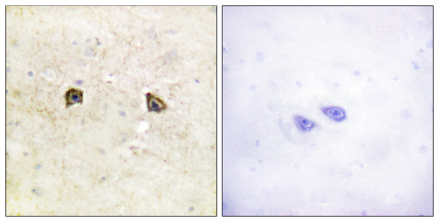 EPH Receptor B1+B2 Antibody (Internal)