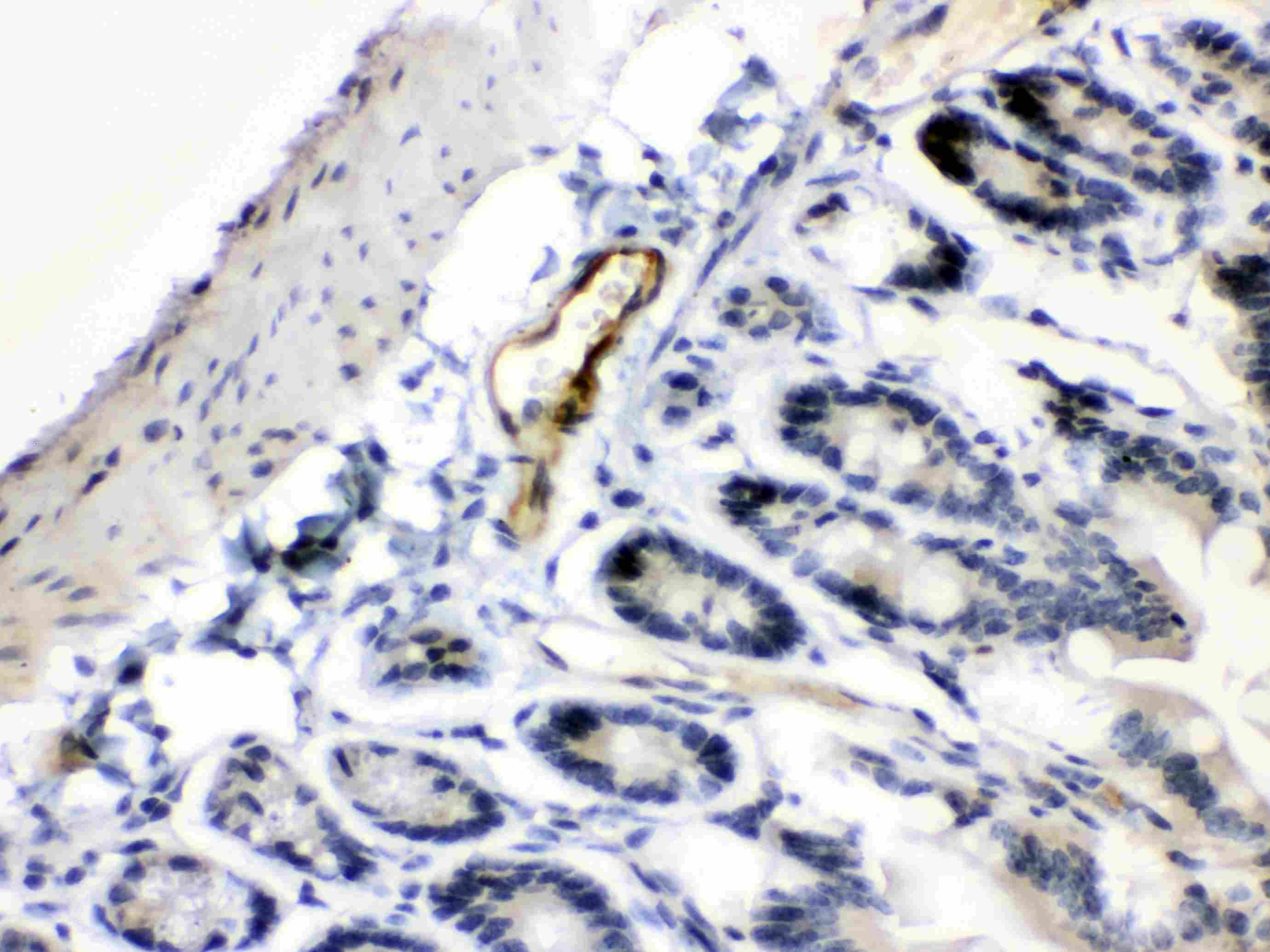 Polyclonal Rabbit anti-Human ANGPTL2 / ARP2 Antibody (IHC, WB)