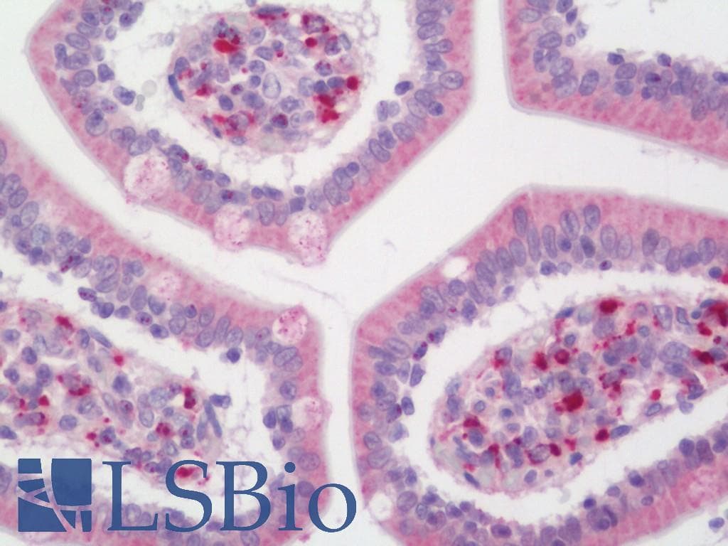 IHC-plus™ Monoclonal Mouse anti-Human MAC-2-BP / LGALS3BP Antibody (clone 3D6, IHC, IF, WB)