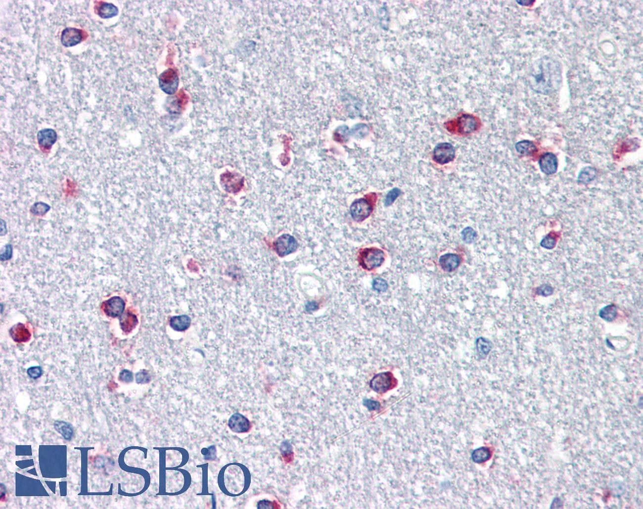 IHC-plus™ Polyclonal Rabbit anti-Mouse PITX3 Antibody (N-Terminus, IHC, IF)
