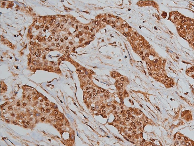 BMP3 Antibody