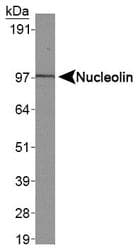 IHC-plus™ Polyclonal Rabbit anti-Human NCL / Nucleolin Antibody (C-Terminus, IHC, WB)