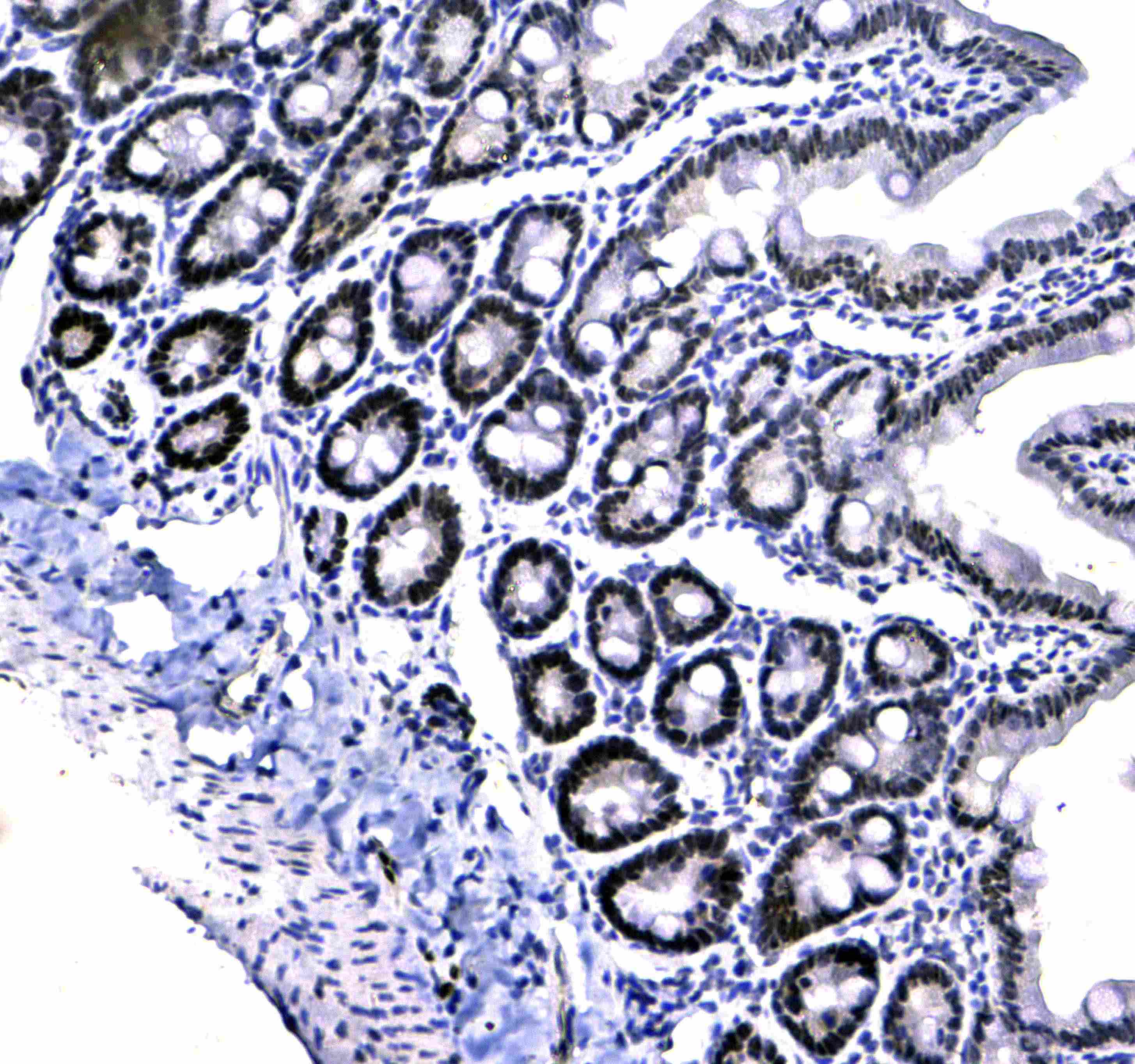 CBX3 / HP1 Gamma Antibody