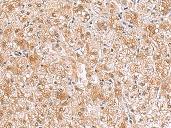 RTKN2 Antibody