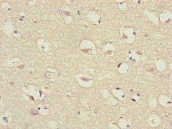 Polyclonal Rabbit anti-Human Translokin / CEP57 Antibody (IHC)