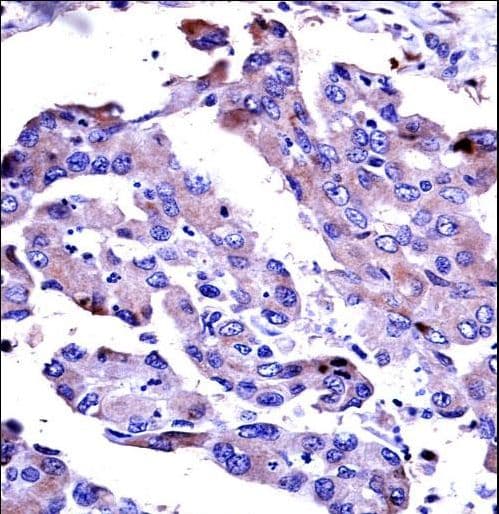 AKT2 Antibody (aa93-123)
