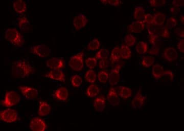 F12 / Factor XII Antibody