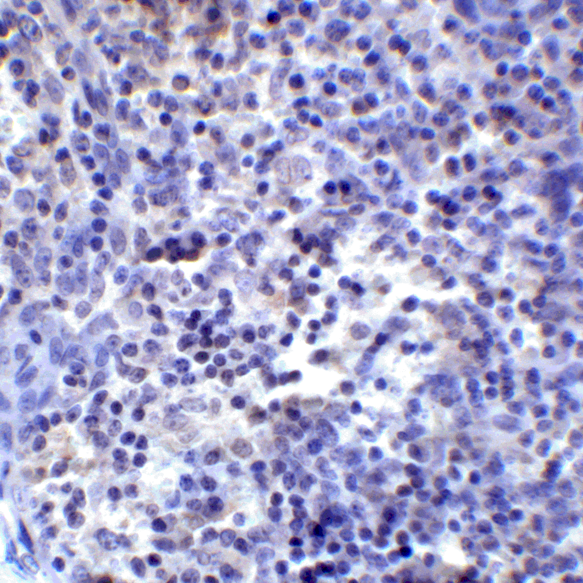 IHC-plus™ Monoclonal Mouse anti-Human PD-L2 / PDCD1LG2 / CD273 Antibody (clone 7C7, IHC, IF, WB)