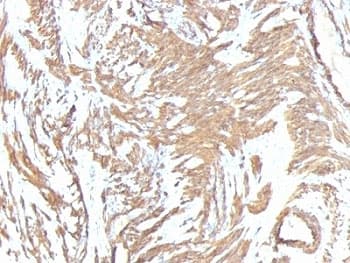 ACTA2 / Smooth Muscle Actin Antibody (N-Terminus, clone 1A4 + ACTA2/791)