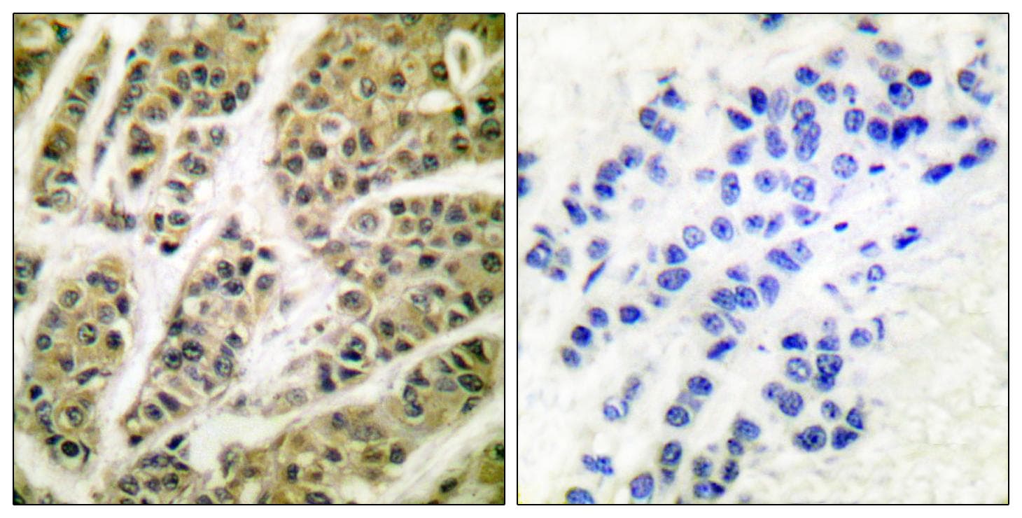 Polyclonal Rabbit anti-Human AKT1 Antibody (Ab-473, IHC, WB)