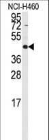 Polyclonal Rabbit anti-Human RMND5B Antibody (aa347-375, IHC, WB)