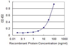 ROR1 Antibody (clone 1B4)