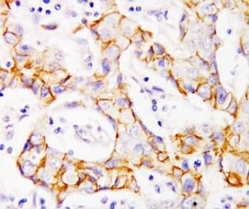 CTNNB1 / Beta Catenin Antibody (aa764-781)