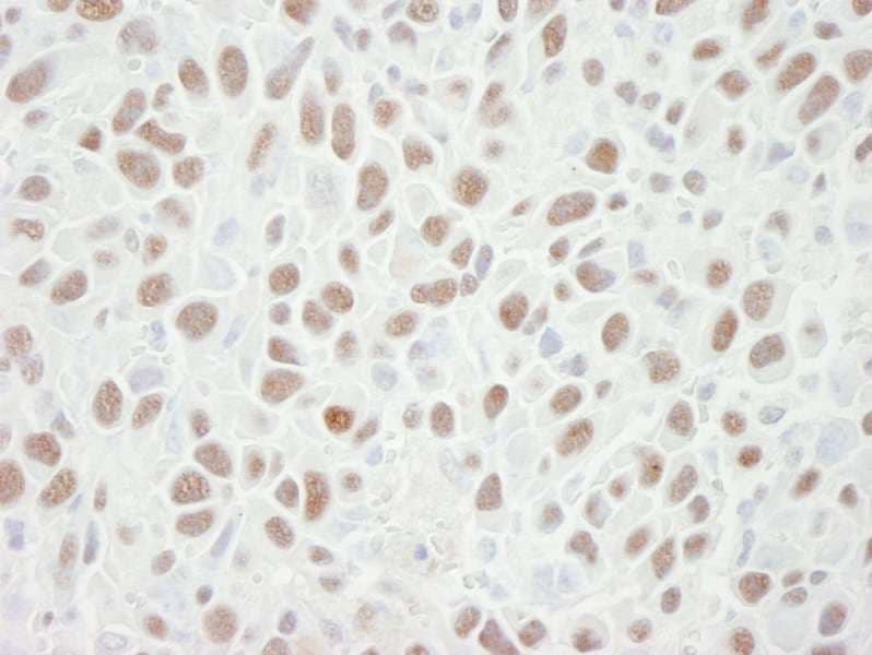 Polyclonal Goat anti-Human MCM6 Antibody (aa775-C-term, IHC)