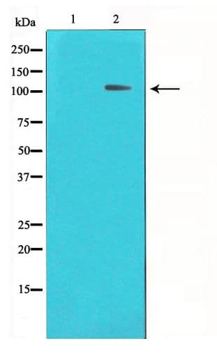 HDAC7 Antibody