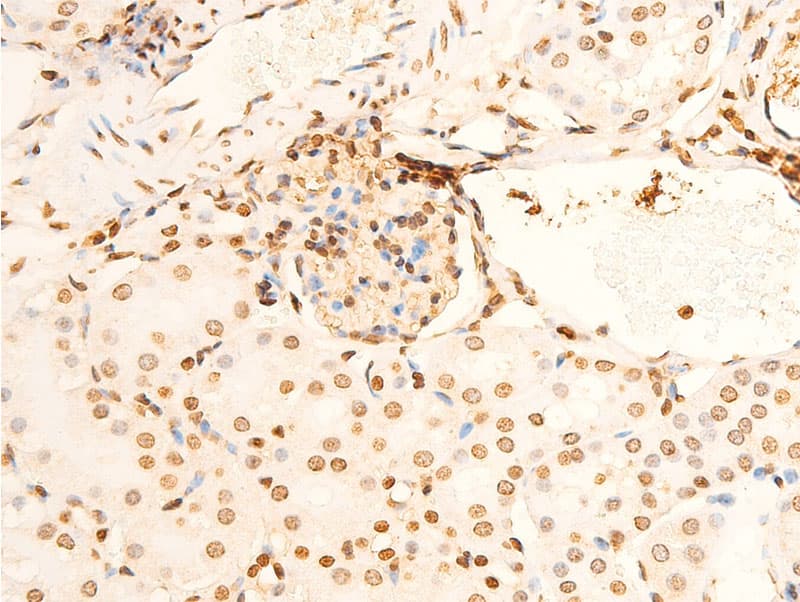 Polyclonal Rabbit anti-Human EIF2S1 Antibody (phospho-Ser51, IHC, IF, WB)