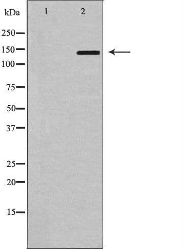Polyclonal Rabbit anti-Human ABCB1 / MDR1 / P Glycoprotein Antibody (IHC, WB)