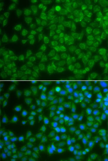 SPIB Antibody