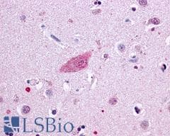 PathPlus™ OPRM1 / Mu Opioid Receptor Antibody (Extracellular Domain)