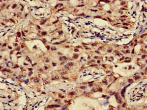NAT1 / AAC1 Antibody