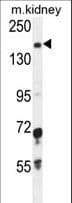 IGSF1 Antibody (aa1270-1297)