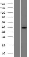 PDHB Protein (Over-Expression Lysate Myc-DDK (Flag))