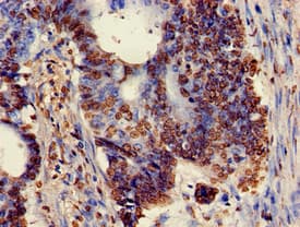 XRCC5 / Ku80 Antibody