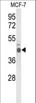 Polyclonal Rabbit anti-Human ELF3 / ESE1 Antibody (aa322-349, WB)