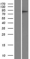 CDRT1 Protein (Over-Expression Lysate Myc-DDK (Flag))