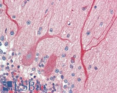 IHC-plus™ NETO2 Antibody (aa174-203)