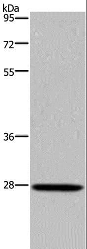Polyclonal Rabbit anti-Human KLK14 / Kallikrein 14 Antibody (IHC, WB)
