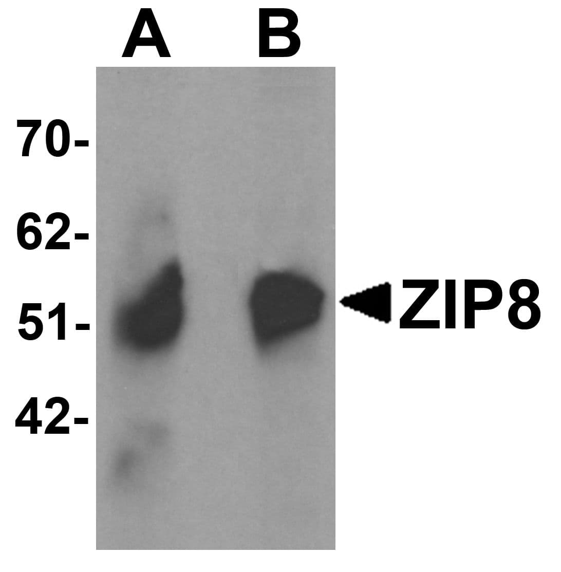 Polyclonal Rabbit anti-Human SLC39A8 / ZIP8 Antibody (IHC, IF, WB)
