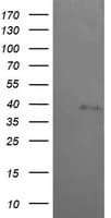 MAP2K3 / MEK3 / MKK3 Antibody (clone OTI6F8)