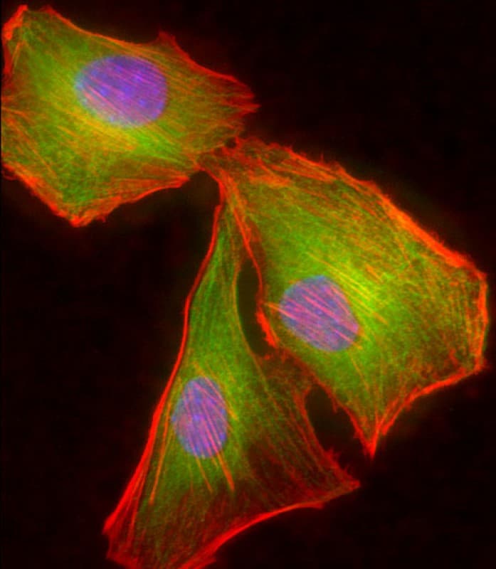 TUBB2A / Tubulin Beta 2A Antibody