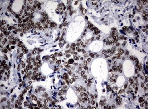 NBN / Nibrin Antibody (aa183-460, clone UMAB100, Carrier-free)