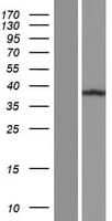 C11orf49 Protein (Over-Expression Lysate Myc-DDK (Flag))
