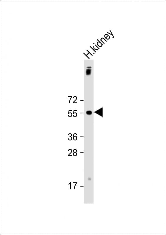 Polyclonal Rabbit anti-Human UGT1A9 Antibody (C-Terminus, WB)