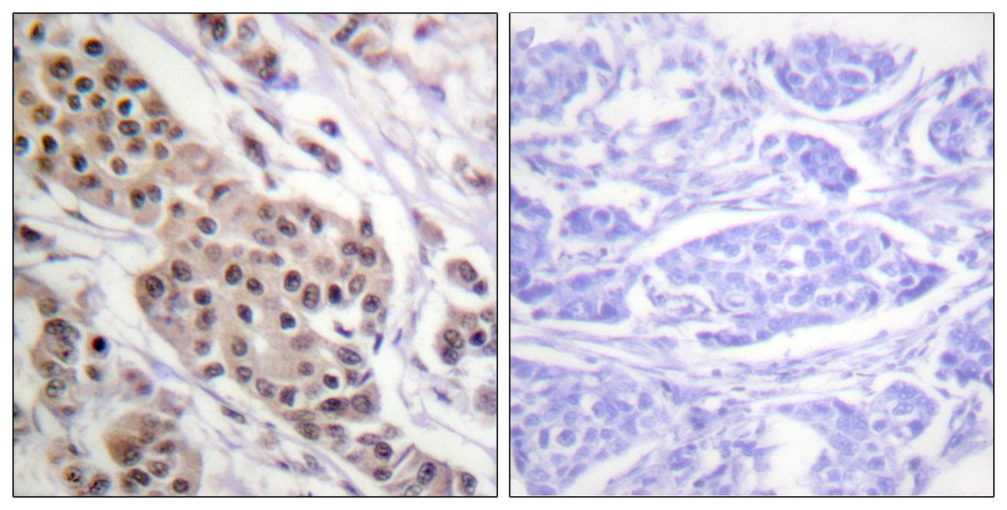 TP53 / p53 Antibody (phospho-Ser392)
